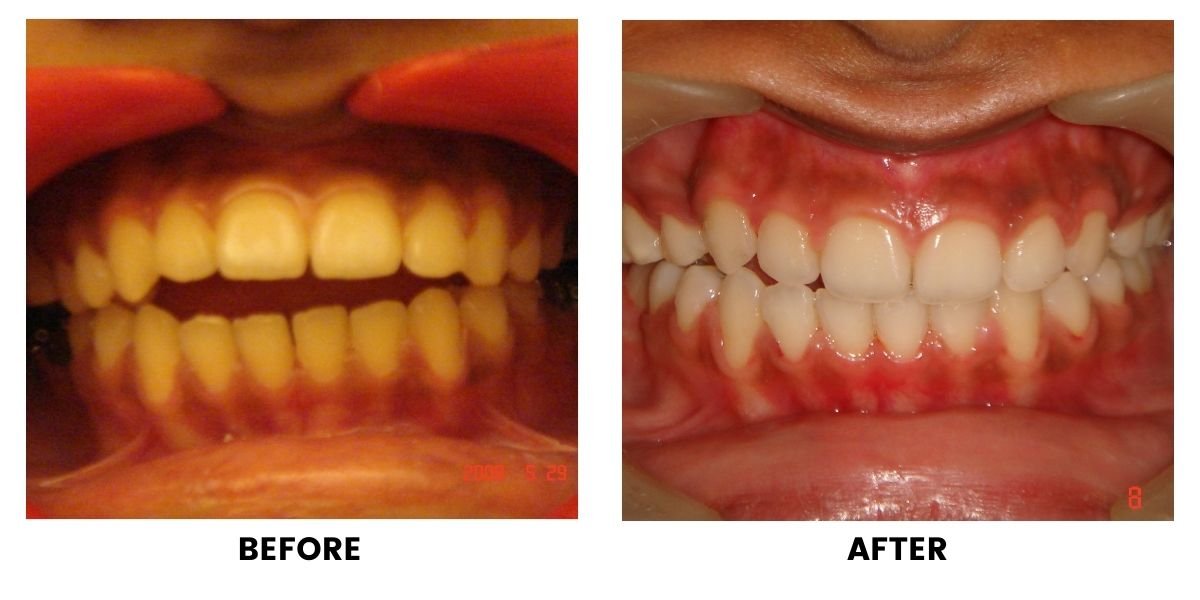 Before and after dental treatment: plate 1 of 38 from the practice’s own record, the patient before treatment on the left and after treatment on the right.