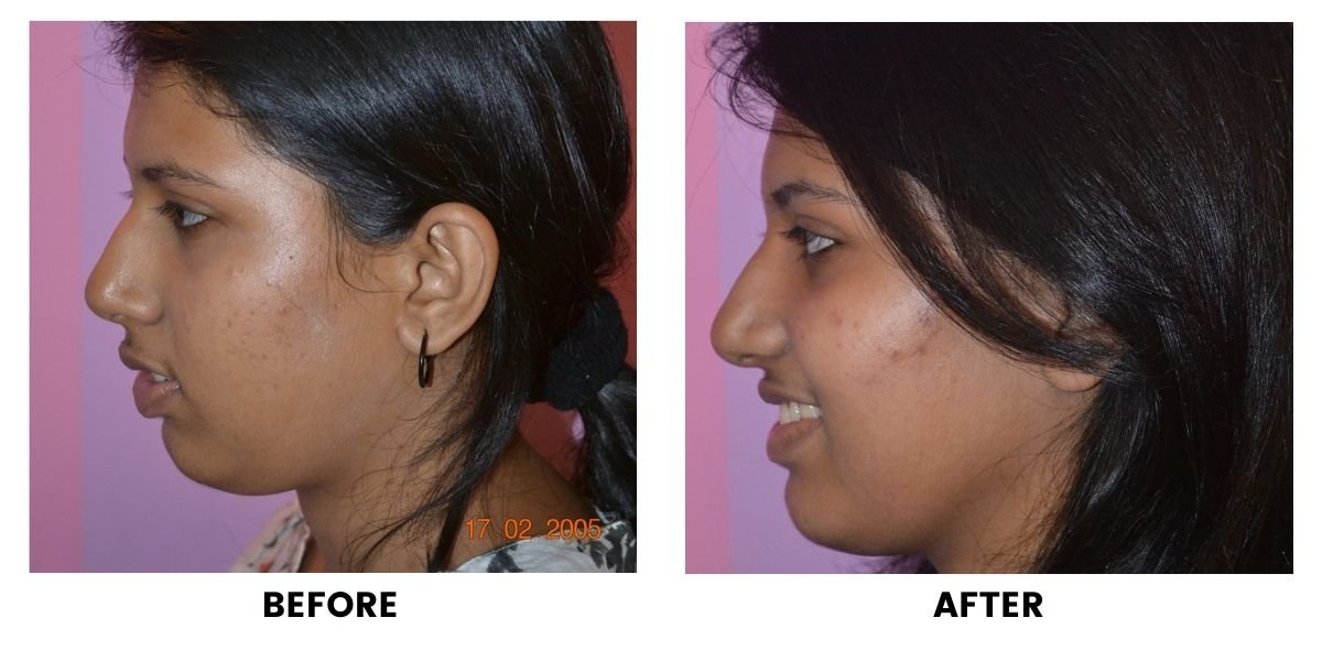 Before and after dental treatment: plate 3 of 38 from the practice’s own record, the patient before treatment on the left and after treatment on the right.