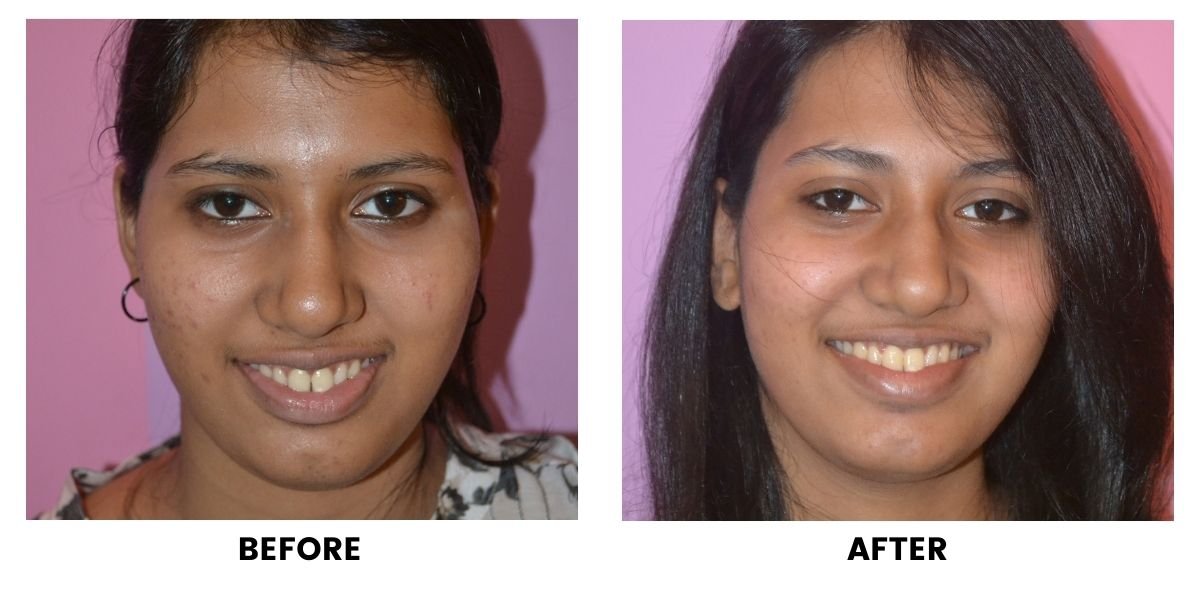 Before and after dental treatment: plate 4 of 38 from the practice’s own record, the patient before treatment on the left and after treatment on the right.