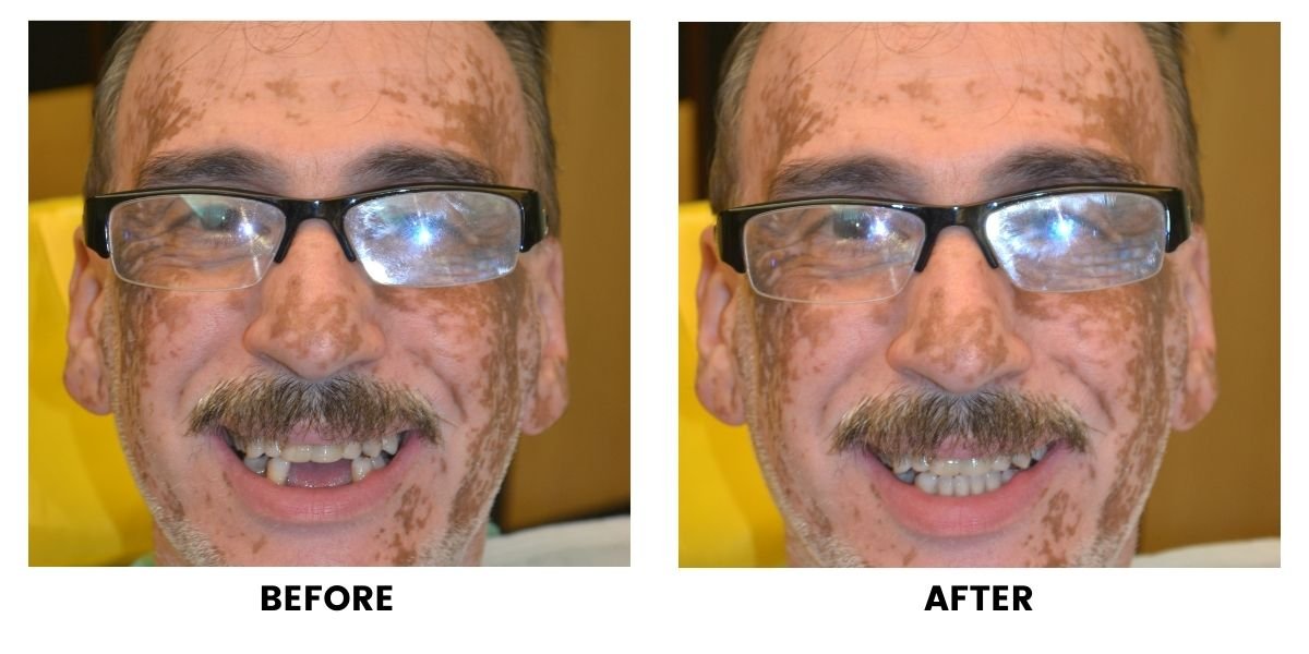 Before and after dental treatment: plate 5 of 38 from the practice’s own record, the patient before treatment on the left and after treatment on the right.