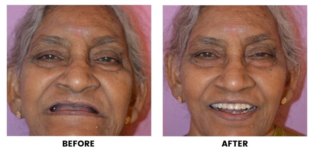 Before and after dental treatment: plate 7 of 38 from the practice’s own record, the patient before treatment on the left and after treatment on the right.