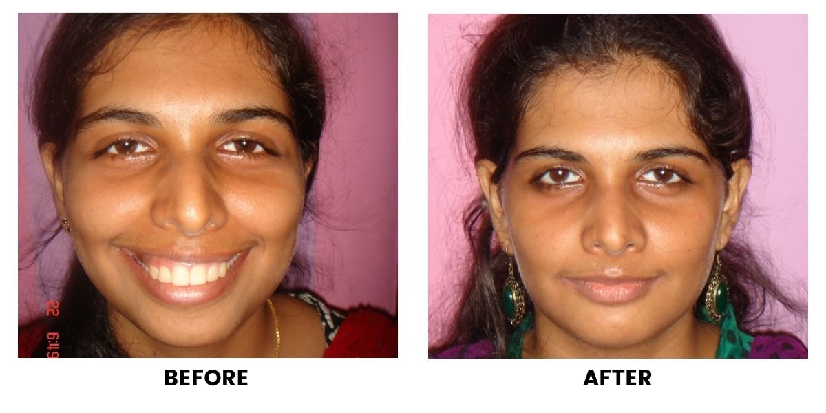 Before and after dental treatment: plate 9 of 38 from the practice’s own record, the patient before treatment on the left and after treatment on the right.