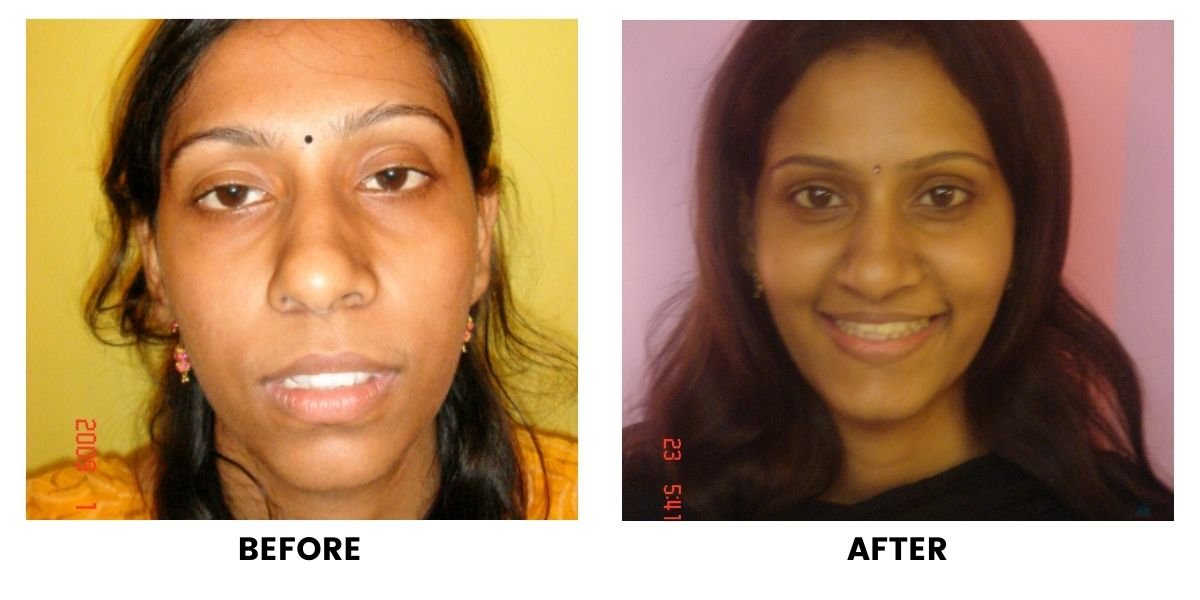 Before and after dental treatment: plate 10 of 38 from the practice’s own record, the patient before treatment on the left and after treatment on the right.