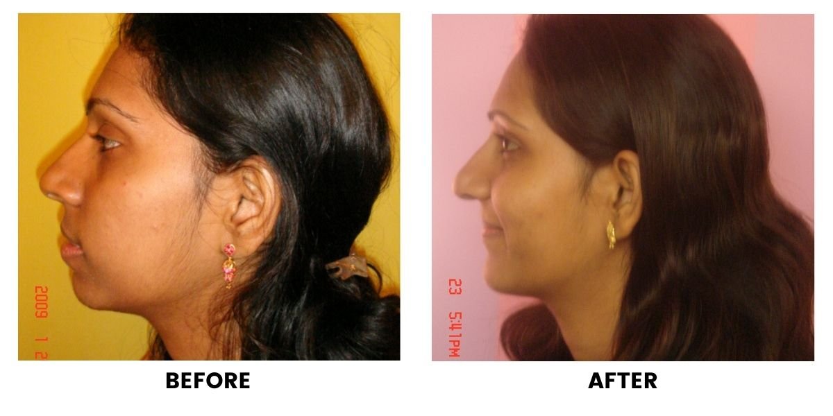 Before and after dental treatment: plate 11 of 38 from the practice’s own record, the patient before treatment on the left and after treatment on the right.