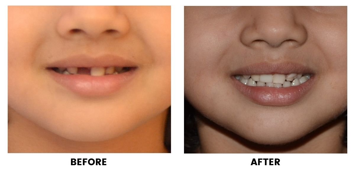 Before and after dental treatment: plate 12 of 38 from the practice’s own record, the patient before treatment on the left and after treatment on the right.