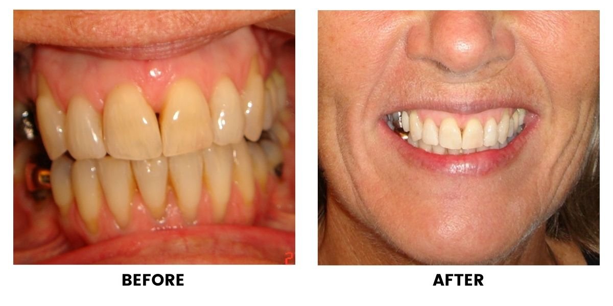 Before and after dental treatment: plate 14 of 38 from the practice’s own record, the patient before treatment on the left and after treatment on the right.