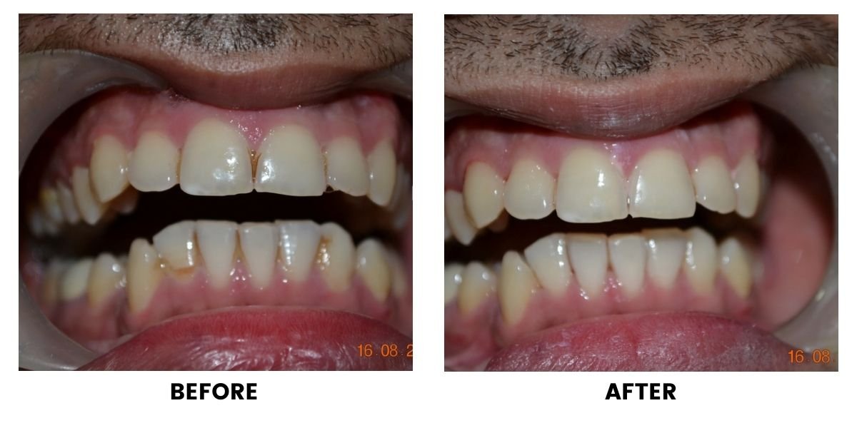 Before and after dental treatment: plate 15 of 38 from the practice’s own record, the patient before treatment on the left and after treatment on the right.