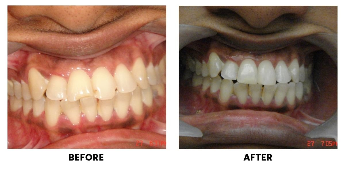 Before and after dental treatment: plate 16 of 38 from the practice’s own record, the patient before treatment on the left and after treatment on the right.