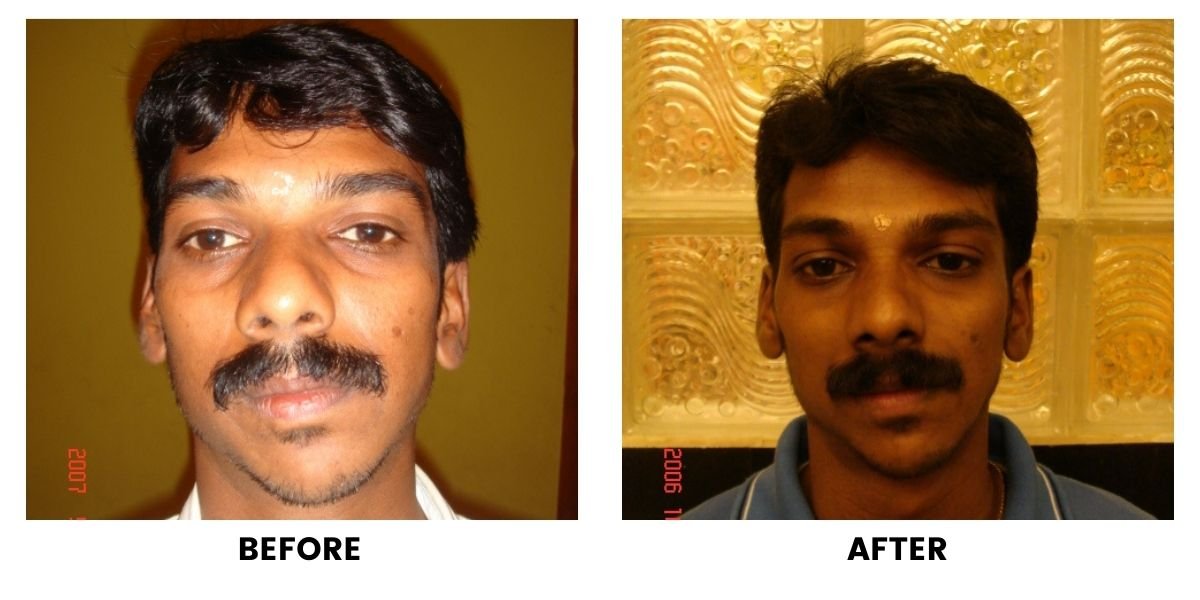 Before and after dental treatment: plate 19 of 38 from the practice’s own record, the patient before treatment on the left and after treatment on the right.