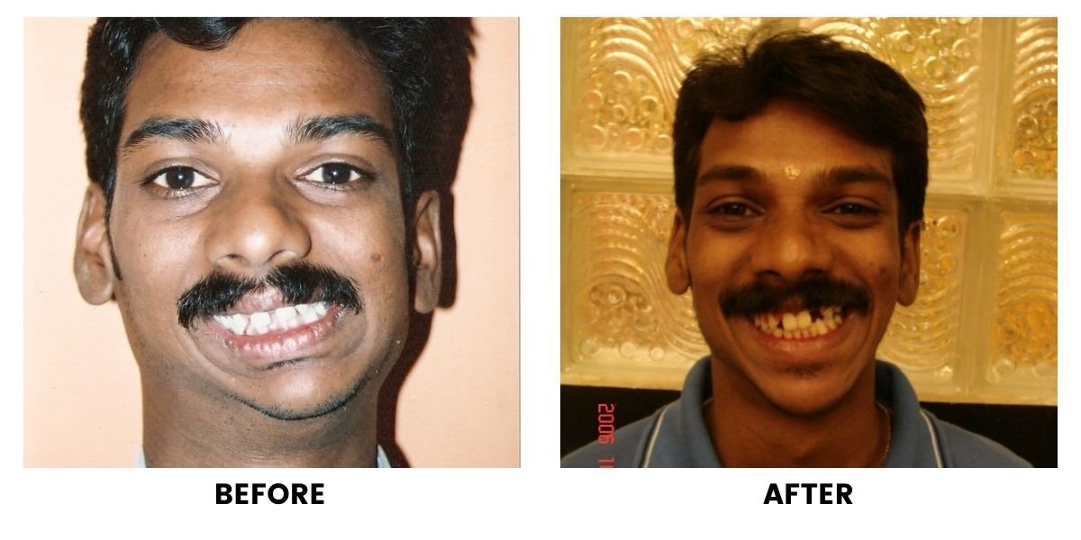 Before and after dental treatment: plate 20 of 38 from the practice’s own record, the patient before treatment on the left and after treatment on the right.