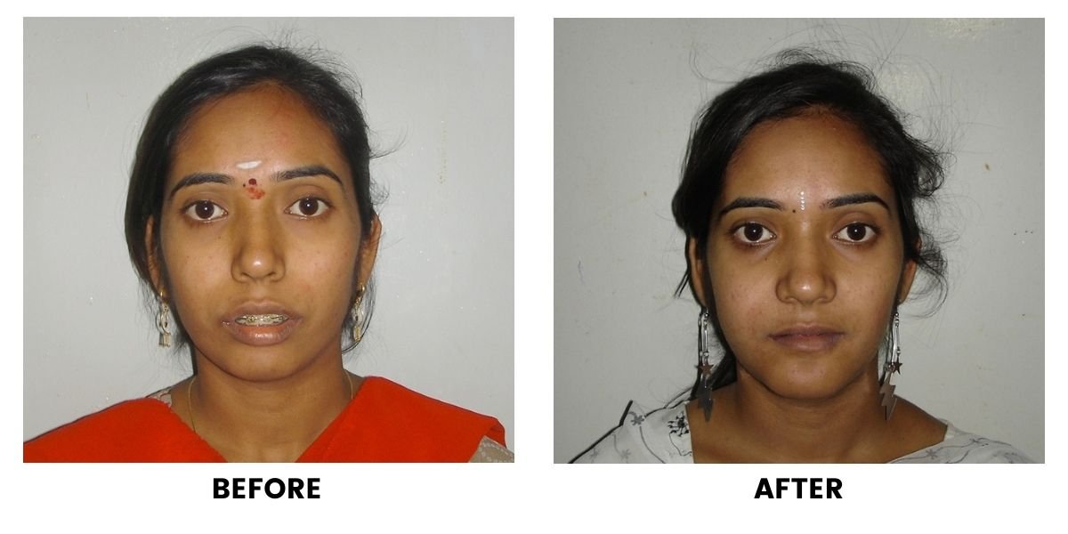 Before and after dental treatment: plate 21 of 38 from the practice’s own record, the patient before treatment on the left and after treatment on the right.