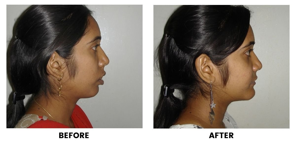 Before and after dental treatment: plate 22 of 38 from the practice’s own record, the patient before treatment on the left and after treatment on the right.