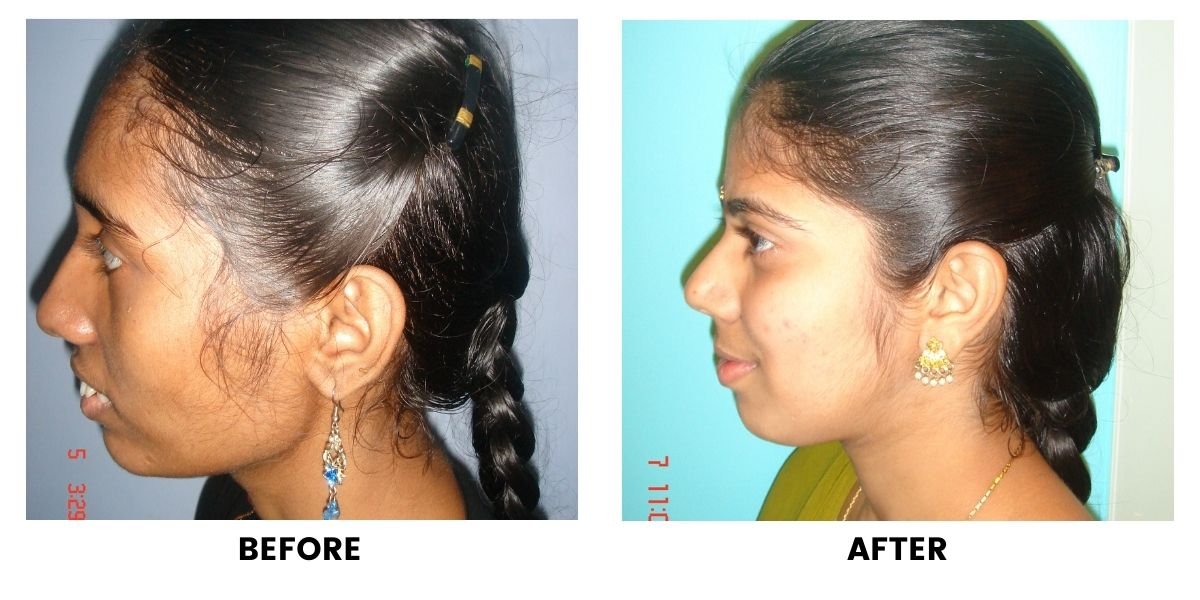 Before and after dental treatment: plate 23 of 38 from the practice’s own record, the patient before treatment on the left and after treatment on the right.