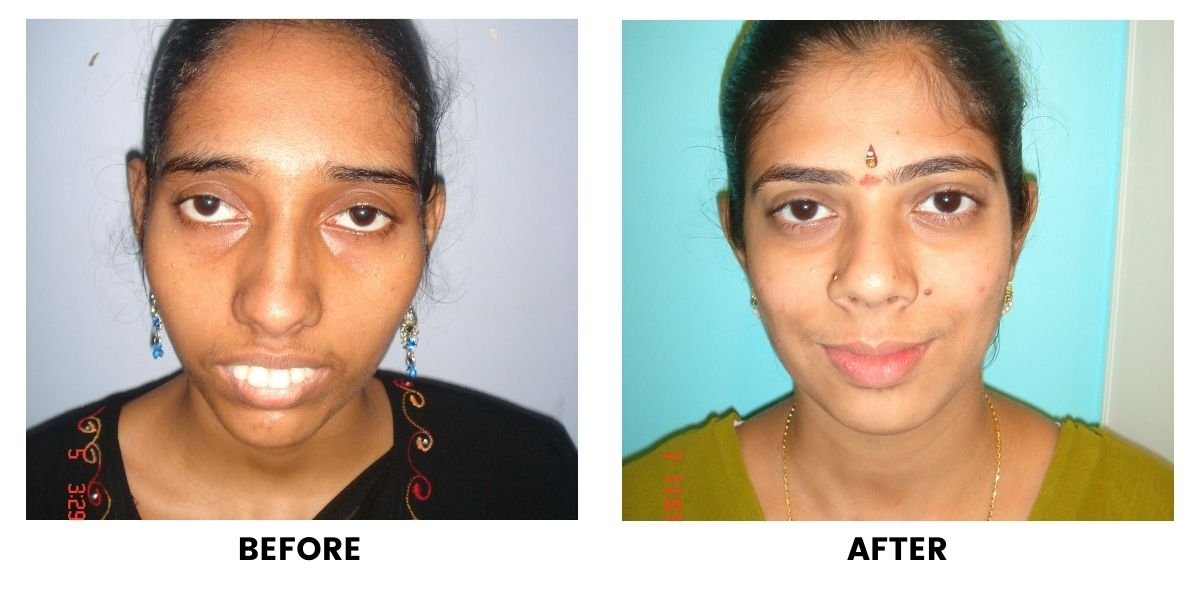 Before and after dental treatment: plate 24 of 38 from the practice’s own record, the patient before treatment on the left and after treatment on the right.