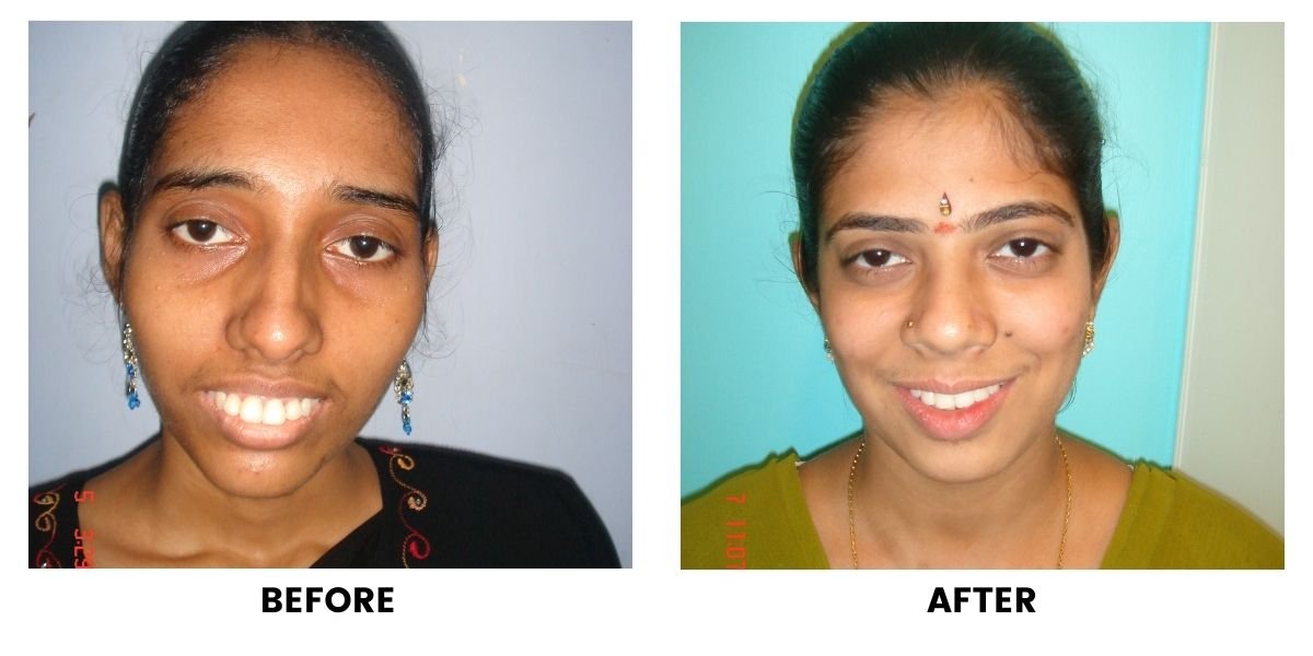 Before and after dental treatment: plate 25 of 38 from the practice’s own record, the patient before treatment on the left and after treatment on the right.