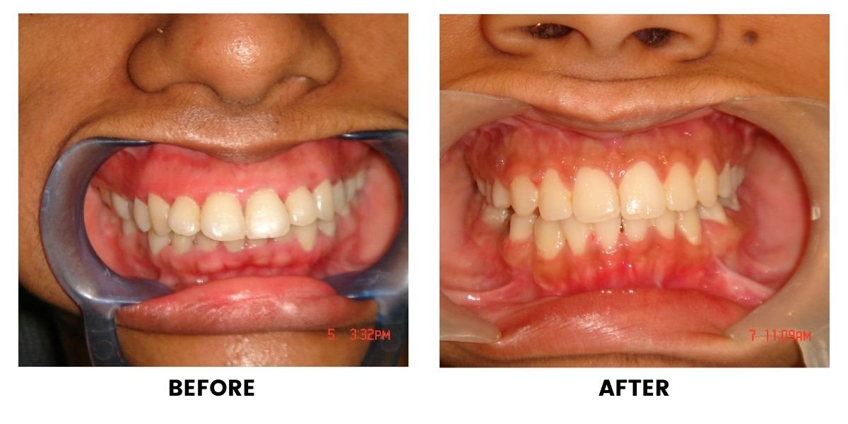 Before and after dental treatment: plate 26 of 38 from the practice’s own record, the patient before treatment on the left and after treatment on the right.