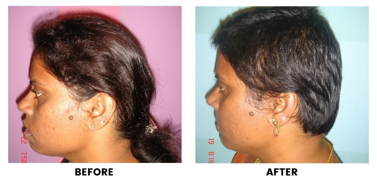 Before and after dental treatment: plate 27 of 38 from the practice’s own record, the patient before treatment on the left and after treatment on the right.
