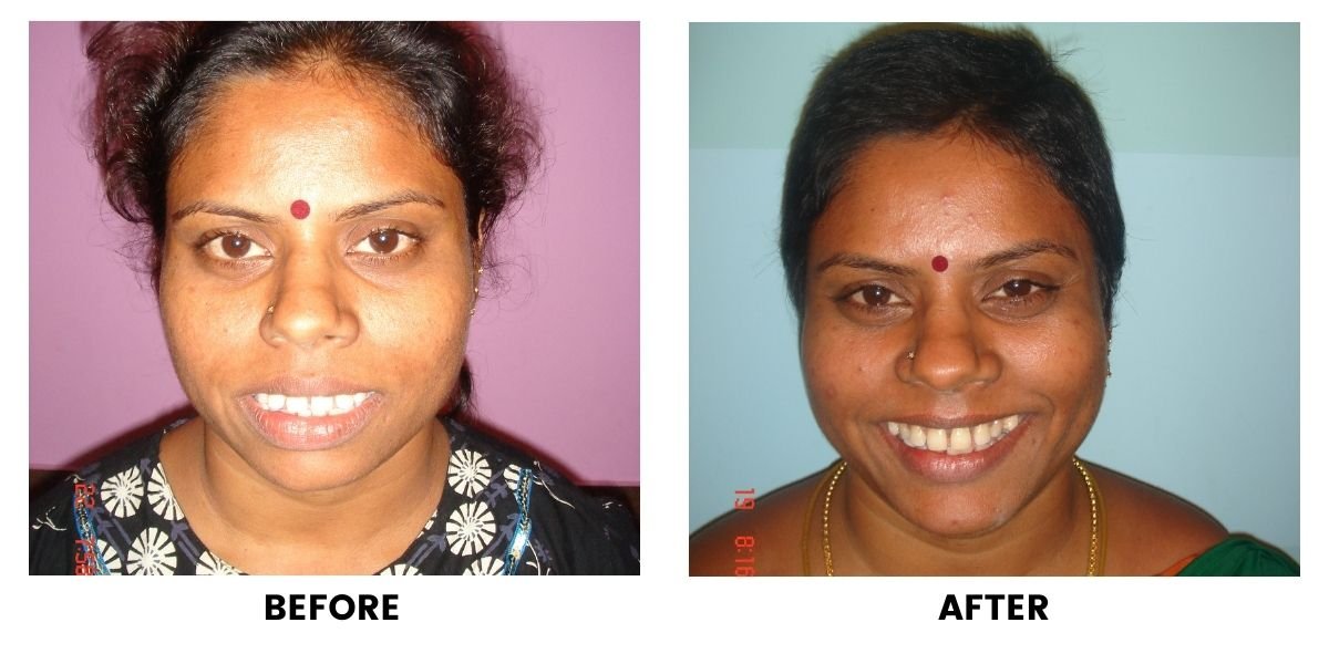 Before and after dental treatment: plate 28 of 38 from the practice’s own record, the patient before treatment on the left and after treatment on the right.