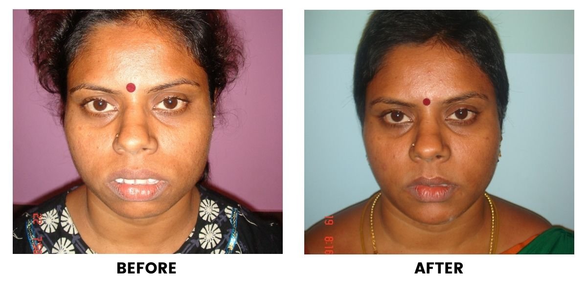 Before and after dental treatment: plate 29 of 38 from the practice’s own record, the patient before treatment on the left and after treatment on the right.