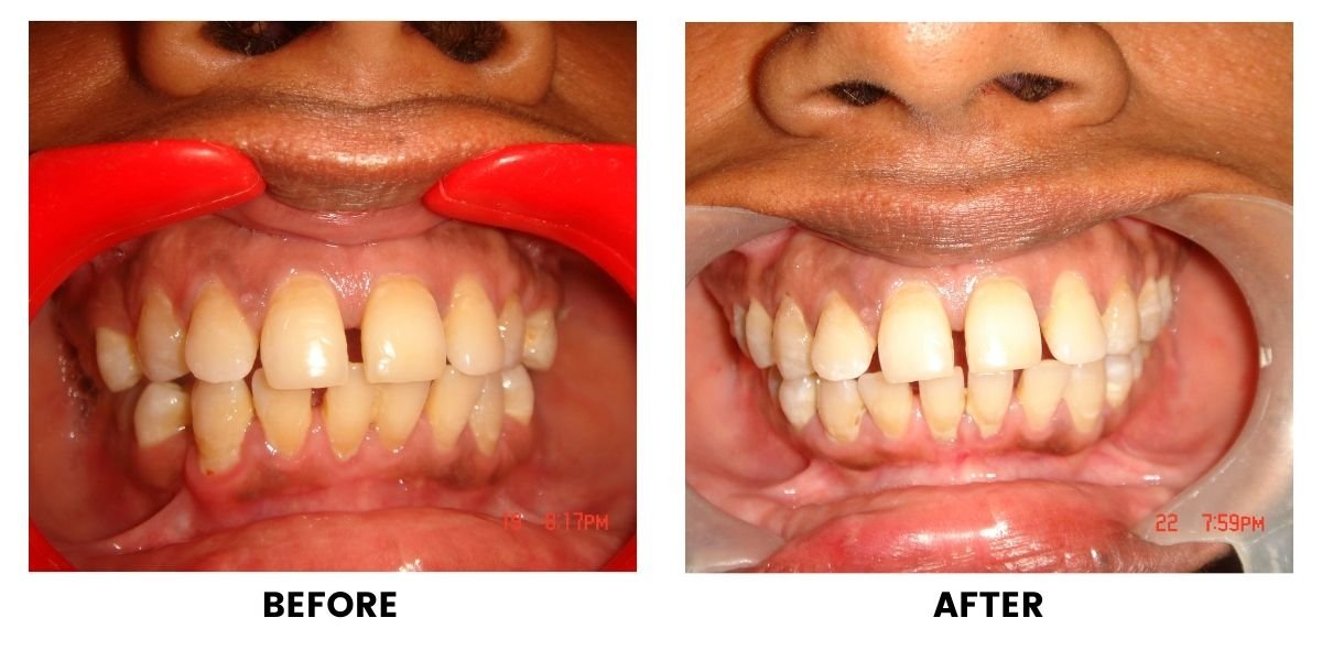 Before and after dental treatment: plate 30 of 38 from the practice’s own record, the patient before treatment on the left and after treatment on the right.