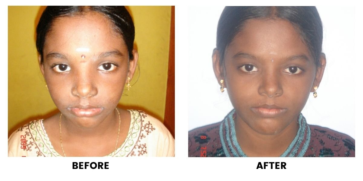 Before and after dental treatment: plate 31 of 38 from the practice’s own record, the patient before treatment on the left and after treatment on the right.