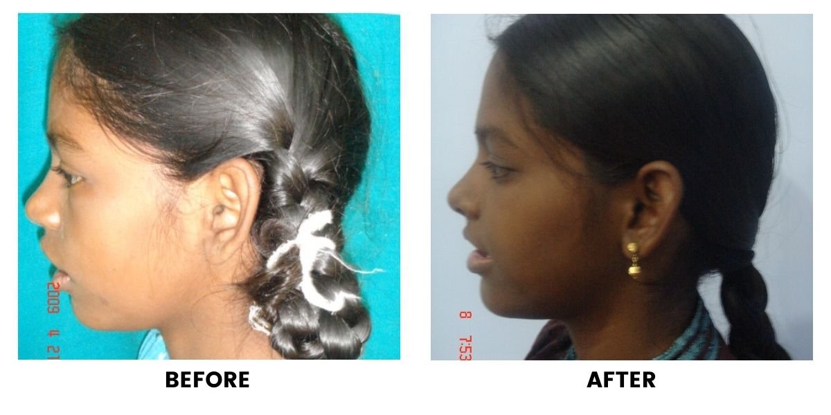 Before and after dental treatment: plate 32 of 38 from the practice’s own record, the patient before treatment on the left and after treatment on the right.