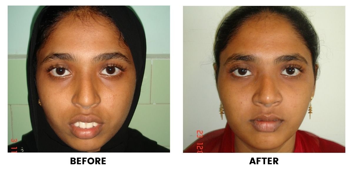 Before and after dental treatment: plate 34 of 38 from the practice’s own record, the patient before treatment on the left and after treatment on the right.