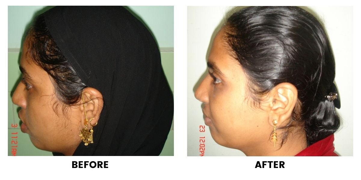 Before and after dental treatment: plate 35 of 38 from the practice’s own record, the patient before treatment on the left and after treatment on the right.