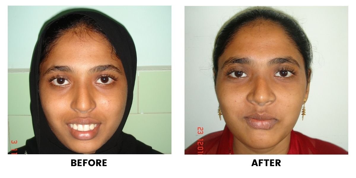 Before and after dental treatment: plate 36 of 38 from the practice’s own record, the patient before treatment on the left and after treatment on the right.