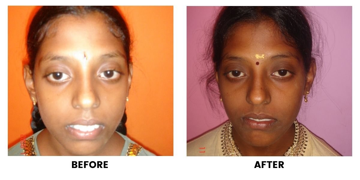 Before and after dental treatment: plate 37 of 38 from the practice’s own record, the patient before treatment on the left and after treatment on the right.