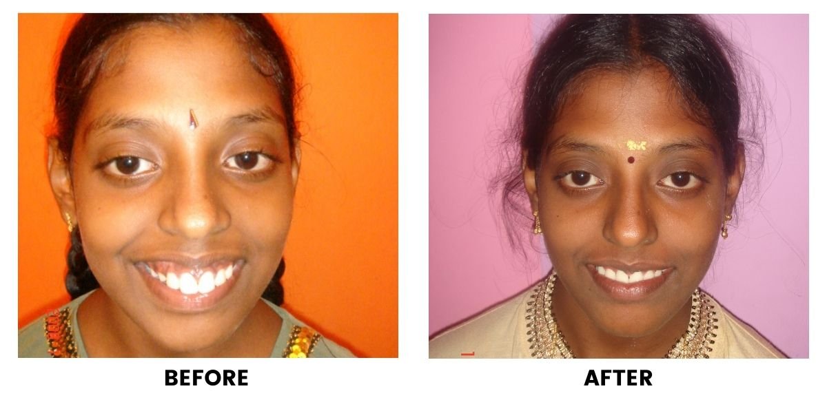 Before and after dental treatment: plate 38 of 38 from the practice’s own record, the patient before treatment on the left and after treatment on the right.