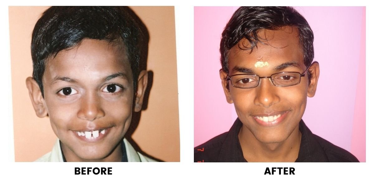 Before and after orthodontic treatment: plate 1 of 53 from the practice’s own record, the patient before treatment on the left and after treatment on the right.