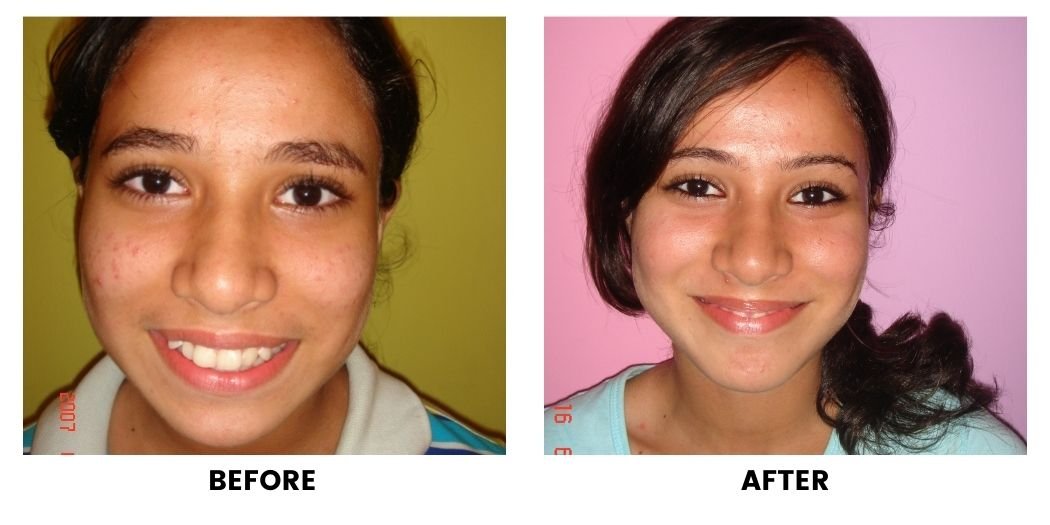 Before and after orthodontic treatment: plate 7 of 53 from the practice’s own record, the patient before treatment on the left and after treatment on the right.