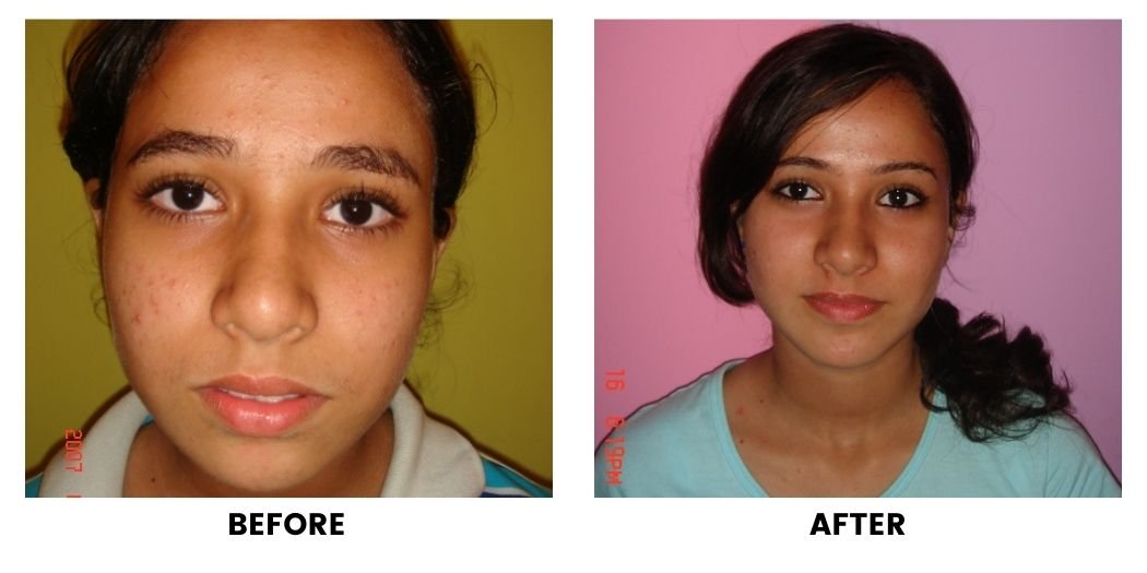 Before and after orthodontic treatment: plate 8 of 53 from the practice’s own record, the patient before treatment on the left and after treatment on the right.