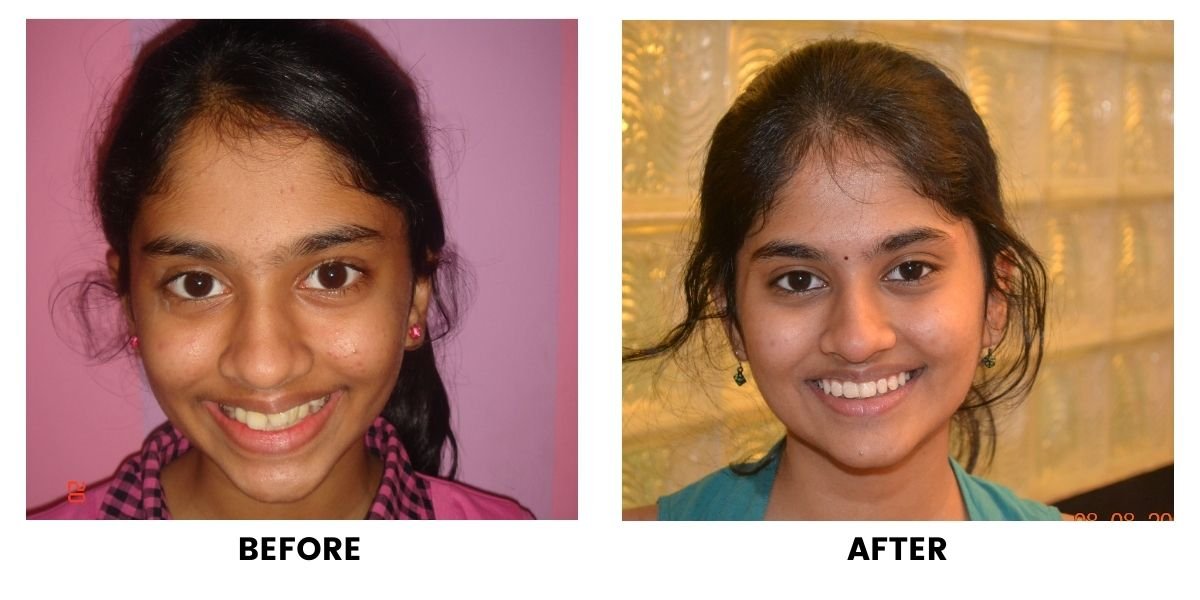 Before and after orthodontic treatment: plate 9 of 53 from the practice’s own record, the patient before treatment on the left and after treatment on the right.