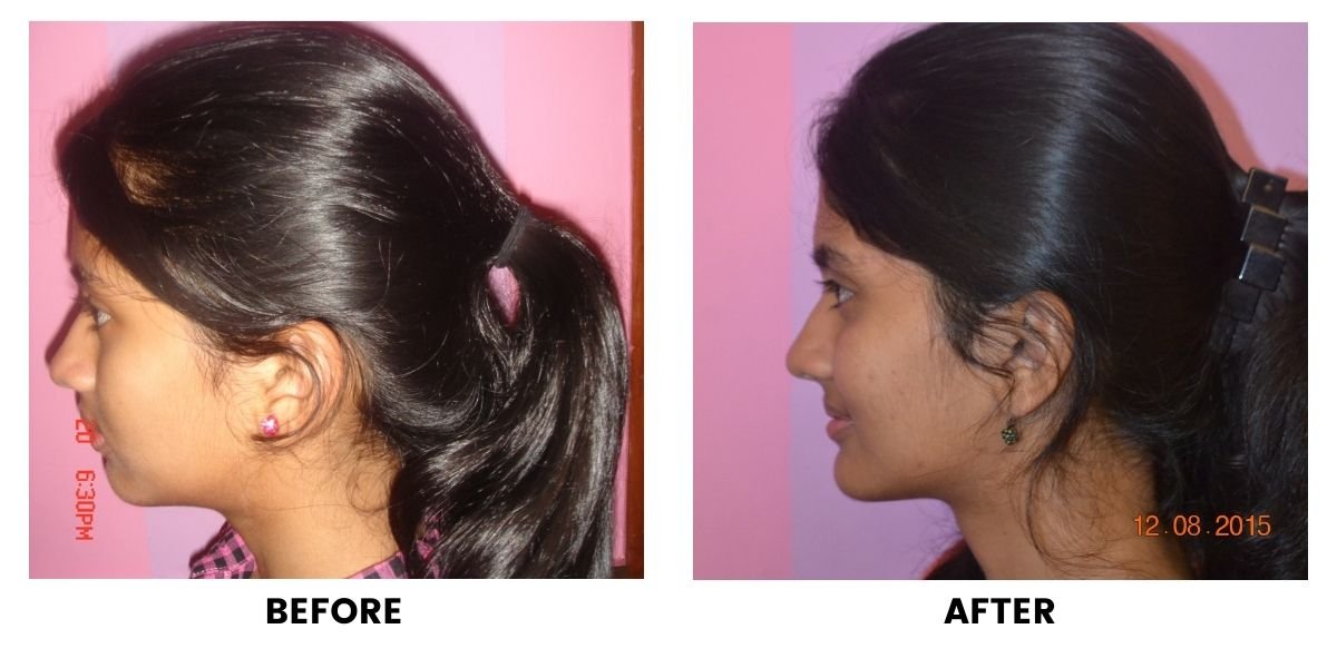 Before and after orthodontic treatment: plate 10 of 53 from the practice’s own record, the patient before treatment on the left and after treatment on the right.