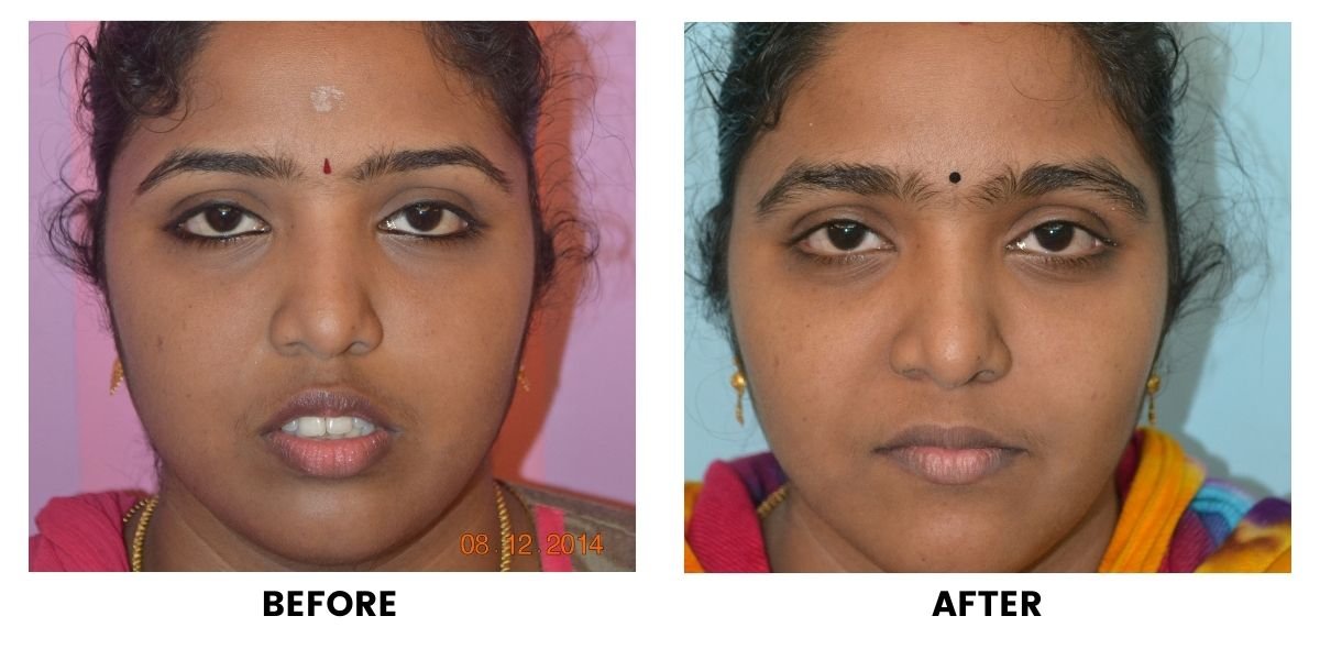 Before and after orthodontic treatment: plate 12 of 53 from the practice’s own record, the patient before treatment on the left and after treatment on the right.