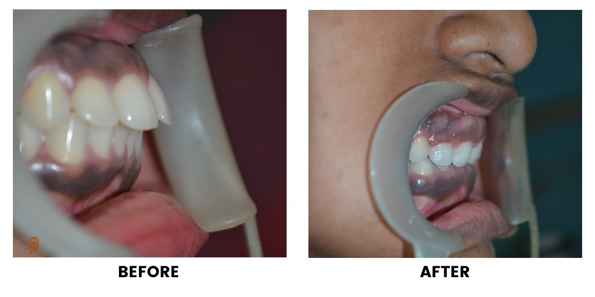 Before and after orthodontic treatment: plate 15 of 53 from the practice’s own record, the patient before treatment on the left and after treatment on the right.