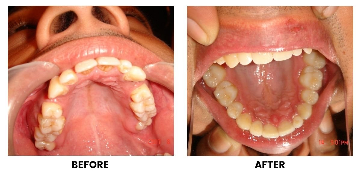 Before and after orthodontic treatment: plate 19 of 53 from the practice’s own record, the patient before treatment on the left and after treatment on the right.