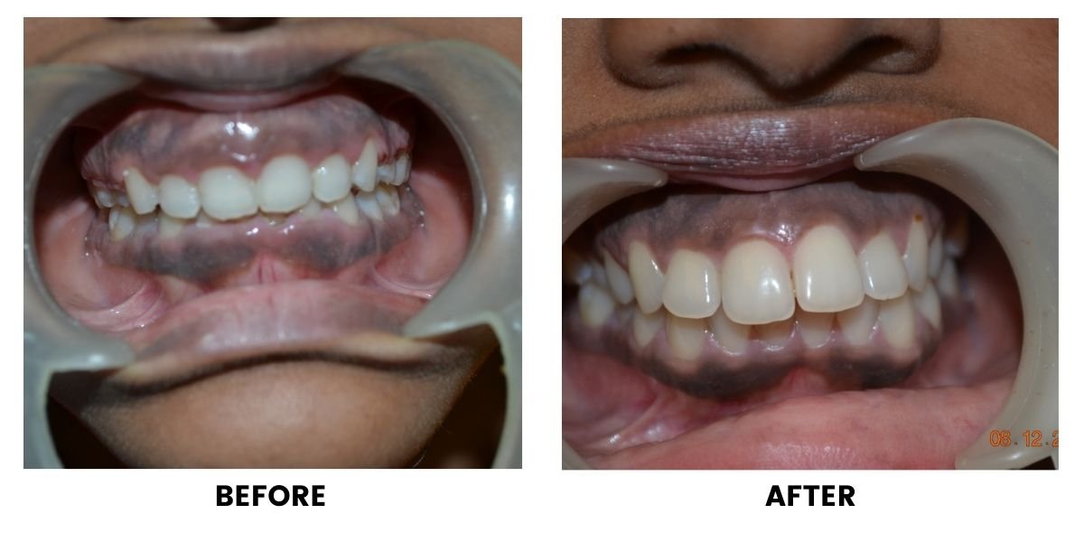 Before and after orthodontic treatment: plate 21 of 53 from the practice’s own record, the patient before treatment on the left and after treatment on the right.