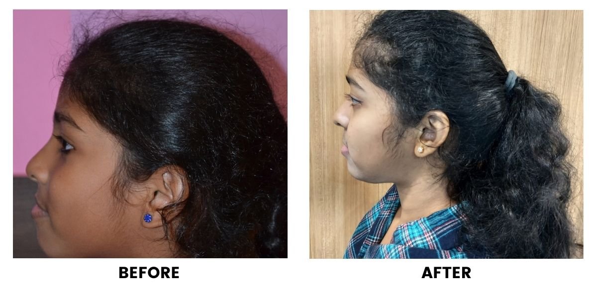 Before and after orthodontic treatment: plate 27 of 53 from the practice’s own record, the patient before treatment on the left and after treatment on the right.