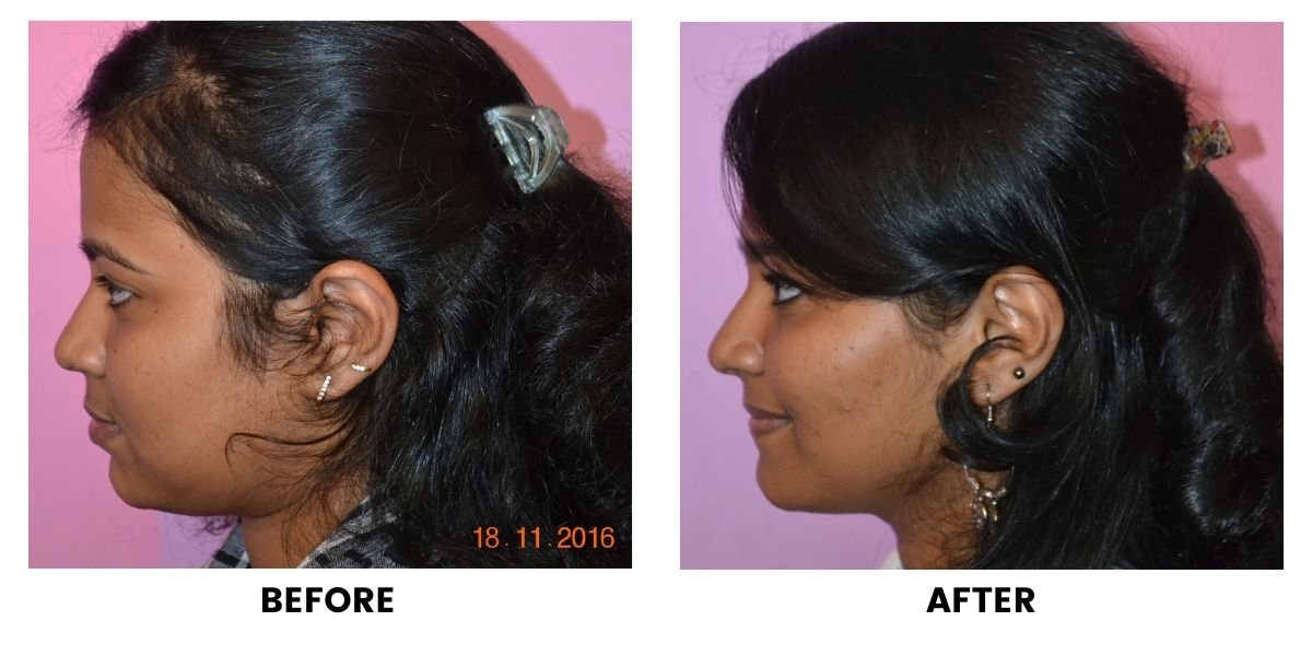 Before and after orthodontic treatment: plate 29 of 53 from the practice’s own record, the patient before treatment on the left and after treatment on the right.
