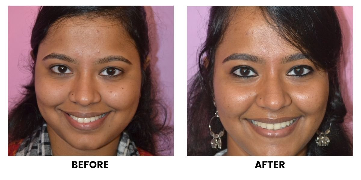 Before and after orthodontic treatment: plate 36 of 53 from the practice’s own record, the patient before treatment on the left and after treatment on the right.