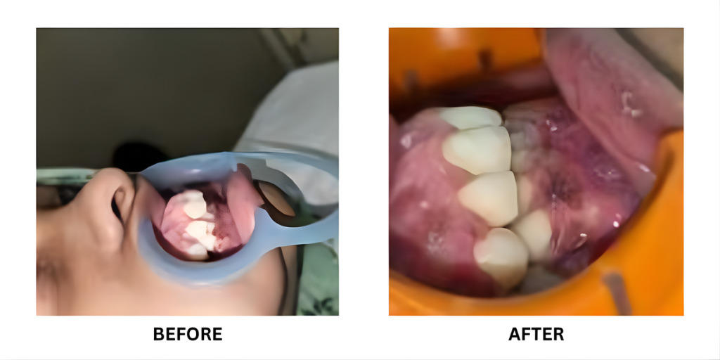 Before and after orthodontic treatment: plate 37 of 53 from the practice’s own record, the patient before treatment on the left and after treatment on the right.