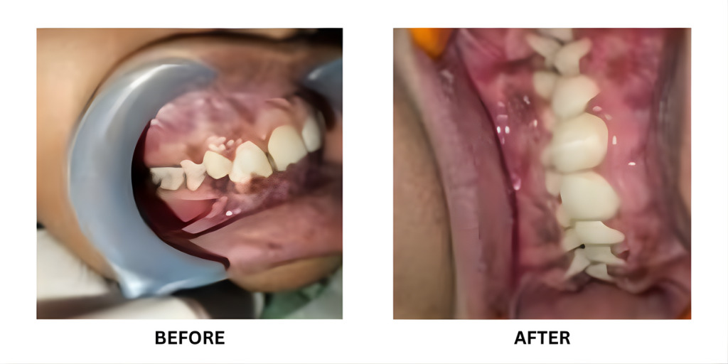 Before and after orthodontic treatment: plate 38 of 53 from the practice’s own record, the patient before treatment on the left and after treatment on the right.