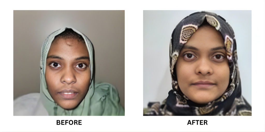 Before and after orthodontic treatment: plate 39 of 53 from the practice’s own record, the patient before treatment on the left and after treatment on the right.