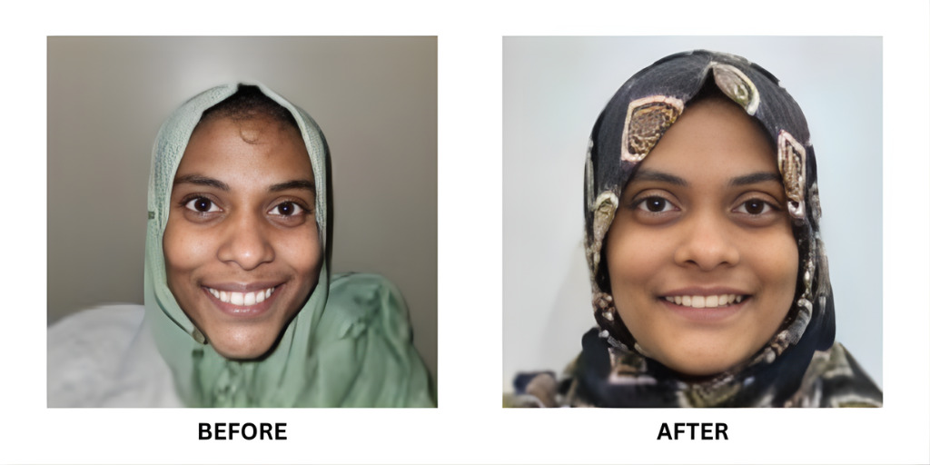 Before and after orthodontic treatment: plate 40 of 53 from the practice’s own record, the patient before treatment on the left and after treatment on the right.
