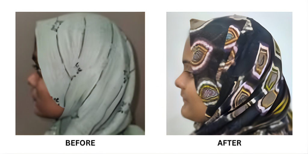 Before and after orthodontic treatment: plate 41 of 53 from the practice’s own record, the patient before treatment on the left and after treatment on the right.