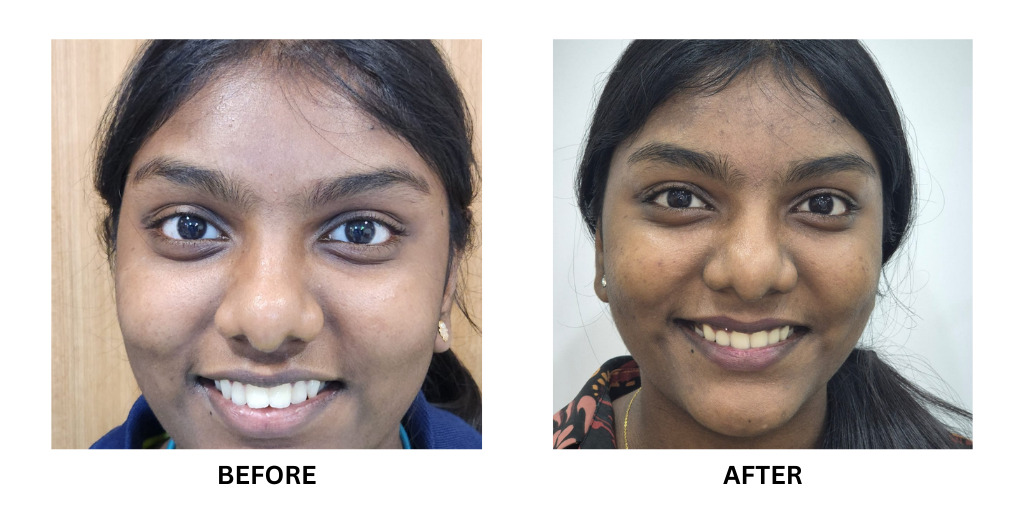 Before and after orthodontic treatment: plate 49 of 53 from the practice’s own record, the patient before treatment on the left and after treatment on the right.