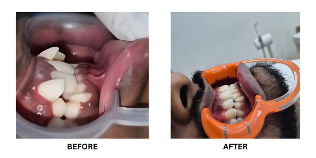 Before and after orthodontic treatment: plate 51 of 53 from the practice’s own record, the patient before treatment on the left and after treatment on the right.